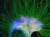 Zhang_neural_stem_cells05.jpg