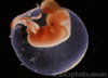 Embryo_at_six_weeks-SPL.jpg