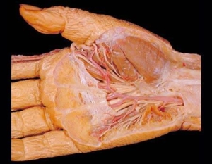 human body dissection 05
