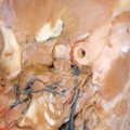 human body dissection 01