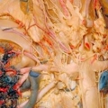human body dissection 06