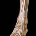 human body dissection 10