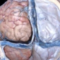 human body dissection 13