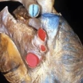 human body dissection 15