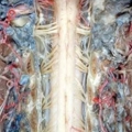 human body dissection 17