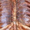 human body dissection 18