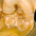 human body dissection 19