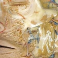 human body dissection 20