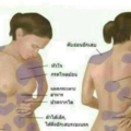 อาการปวดบอกอะไร